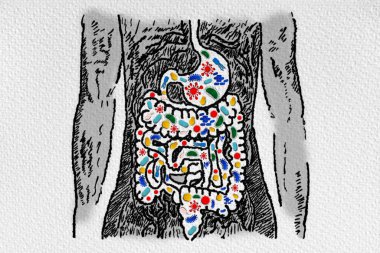 Gut Microbiome and Probiotics - Association with Gastrointestinal Diseases - Leaky Gut - Dysbiosis - Small Intestinal Bacterial Overgrowth - Conceptual Illustration  clipart