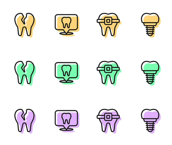 Fixez Ligne Dents Avec Appareil Dentaire Dent Cassée Emplacement Clinique — Image vectorielle