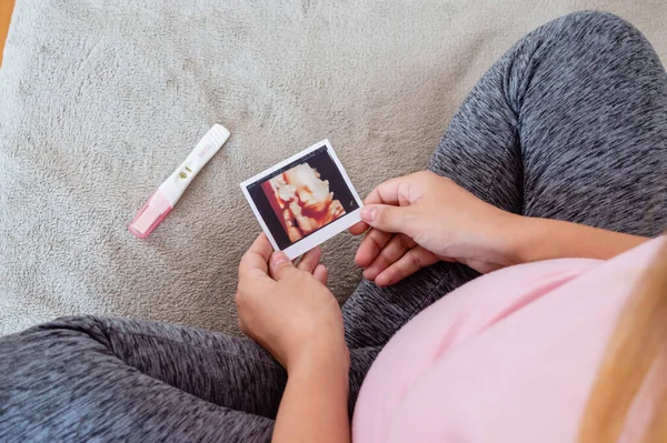 Arriba Ver Mujer Embarazada Sentada Habitación Viendo Foto Impresión Ultrasonido — Foto de Stock