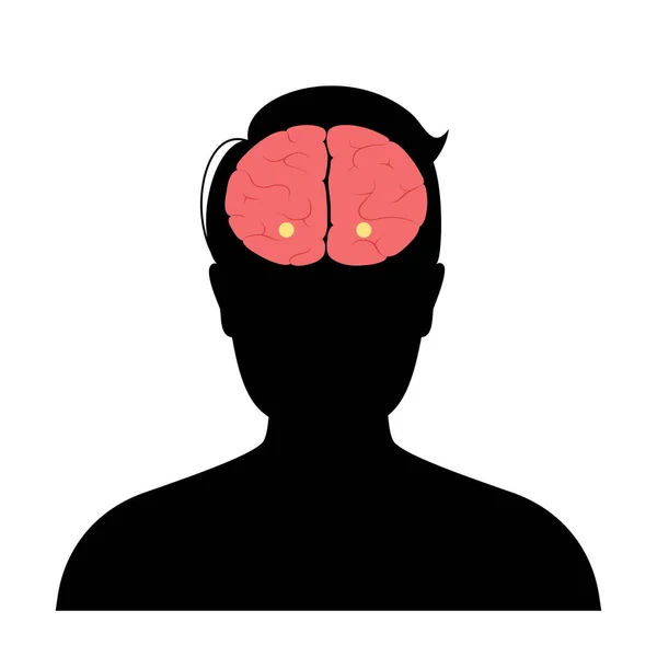 Mozková amygdala anatomie — Stockový vektor