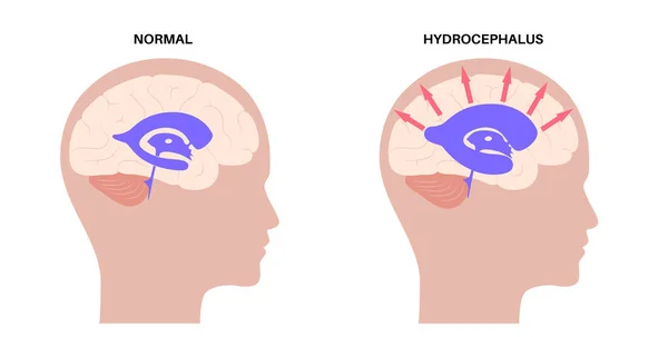 Ventricular system concept — Stock Vector