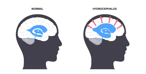 Conceito do sistema ventricular —  Vetores de Stock