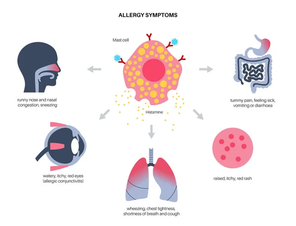 Concept des symptômes d'allergie — Image vectorielle