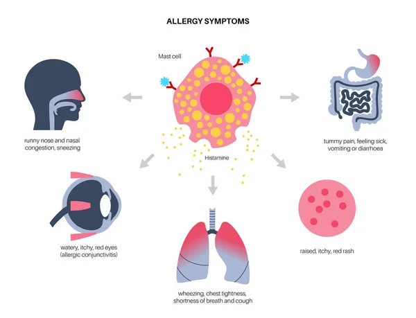 Allergia tünetei koncepció — Stock Vector