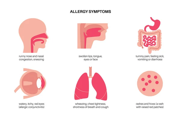 Allergy symptoms concept — Stock Vector