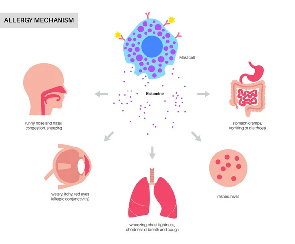 Konzept für Allergiesymptome — Stockvektor