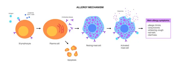 알레르기 메커니즘 다이어그램 — 스톡 벡터