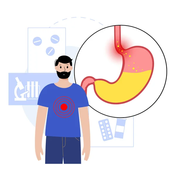 Enfermedad por reflujo gastroesofágico — Archivo Imágenes Vectoriales