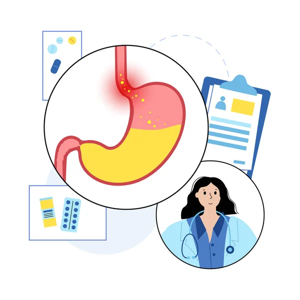 Gastrooesophagealis Reflux betegség — Stock Vector