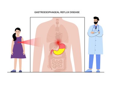 Gastroözofageal reflü hastalığı