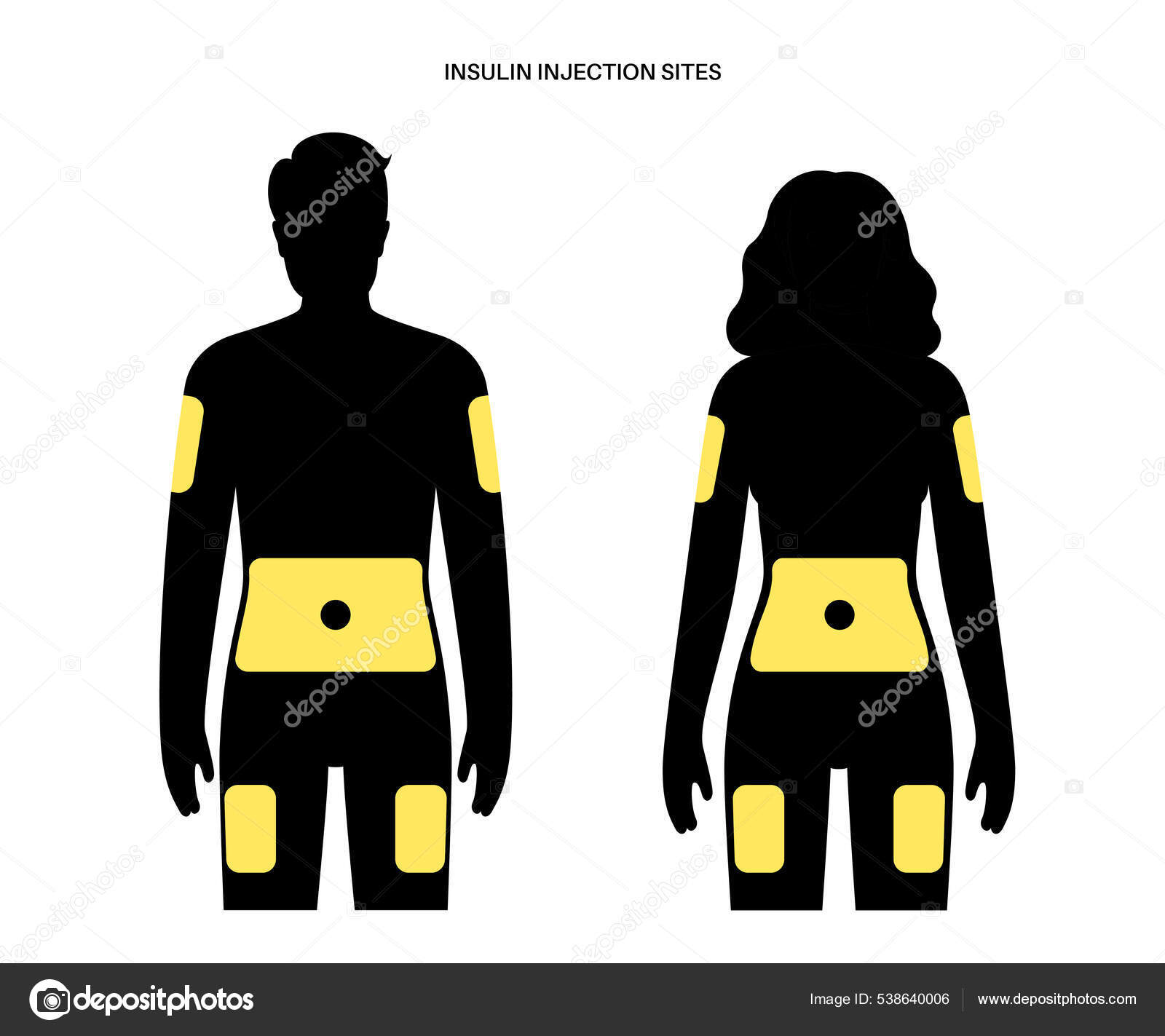 Insulin injection sites Stock Illustration by ©Pikovit 538640006