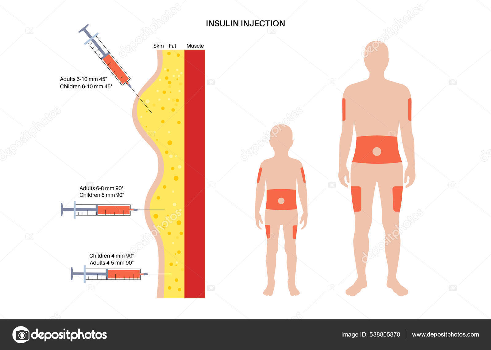 Locais de injeção de insulina imagem vetorial de © Pikovit 538805870