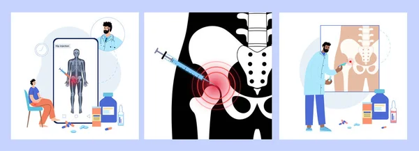 Injection articulaire de la hanche — Image vectorielle