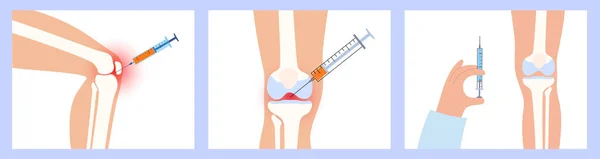 Procédure d'injection du genou — Image vectorielle