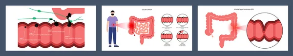 Concept des maladies intestinales — Image vectorielle