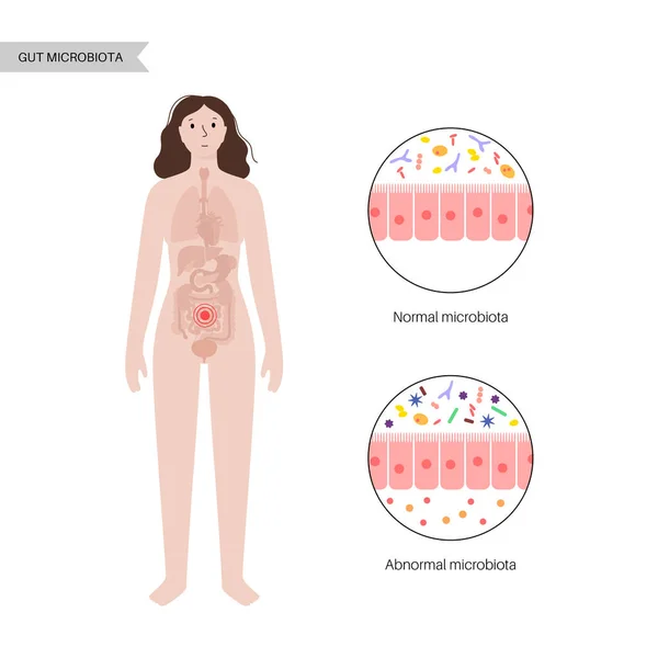 Microbiota intestinal humana — Vector de stock