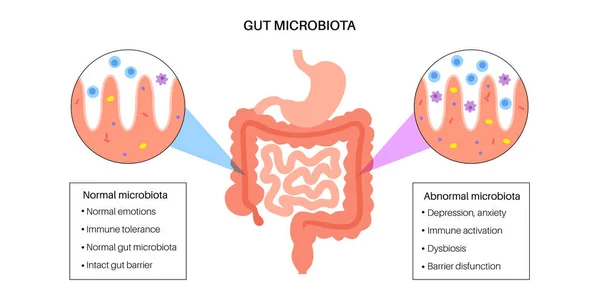 Microbiota intestinal humana — Vector de stock