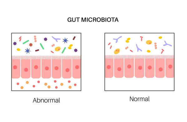 Мікробіота кишечника людини — стоковий вектор