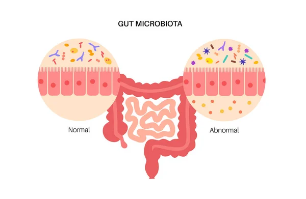 Microbiota intestinale umano — Vettoriale Stock