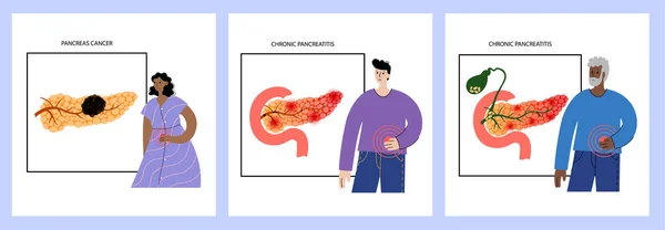 Maladie du pancréas et cancer — Image vectorielle