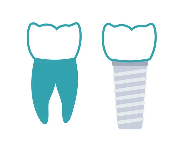 Procedimento de implante dentário —  Vetores de Stock