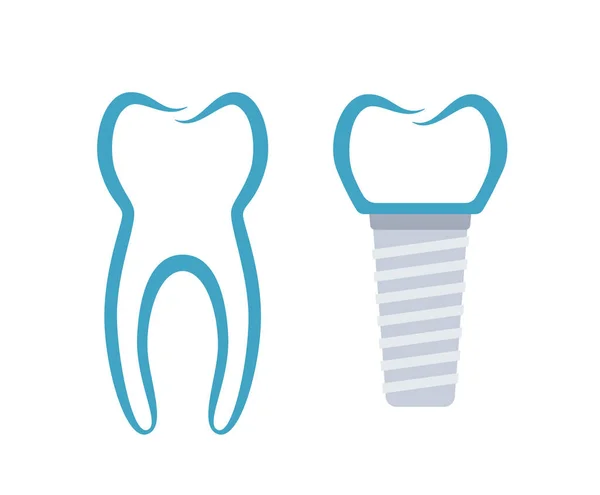 Zubní implantát postup — Stockový vektor