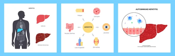 Otoimmün hepatit hastalığı — Stok Vektör