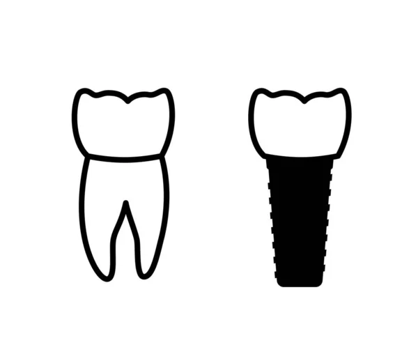 Dental implant prosedürü — Stok Vektör