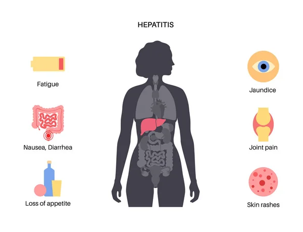 Autoimmune hepatitis disease — 스톡 벡터