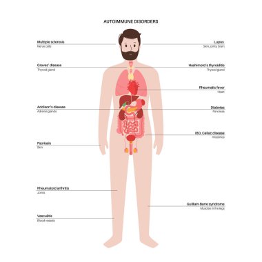 Otoimmün hastalıklar