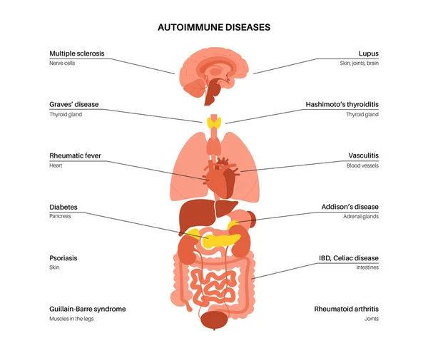 Autoimmune disorders diseases — Image vectorielle