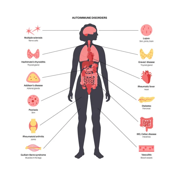 Autoimmune disorders diseases — ストックベクタ