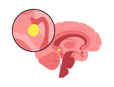 Beyin epifizi anatomisi.