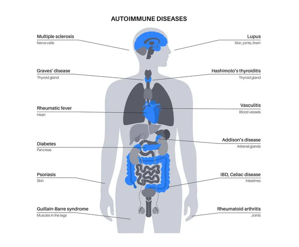 Autoimmune disorders diseases — Vector de stock