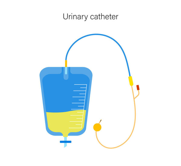 Urinary catheter equipment. Empty bladder and collect urine in a leg bag. Tube from urethra to the internal organ. Urethral drainage hose. Difficulty peeing naturally flat vector illustration