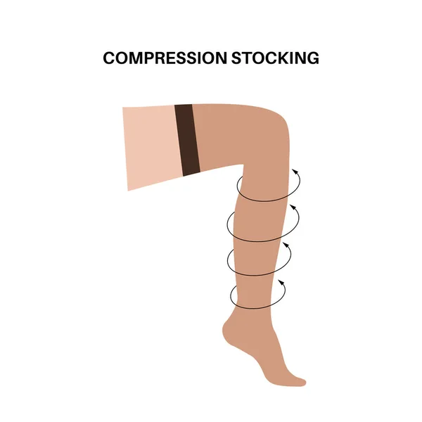 Compression Stocking Concept Pressure Problems Varicose Veins Special Fitness Socks — Stock Vector
