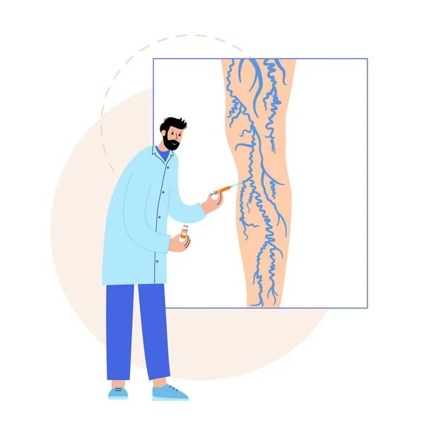 정맥류 정맥류와 용액이나 거품을 도관을 정맥에 주입하는 의학적 — 스톡 벡터