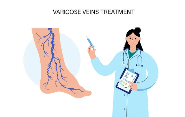 Spataderen Concept Zwelling Pijn Menselijke Benen Diagnose Behandeling Van Vaatziekten — Stockvector