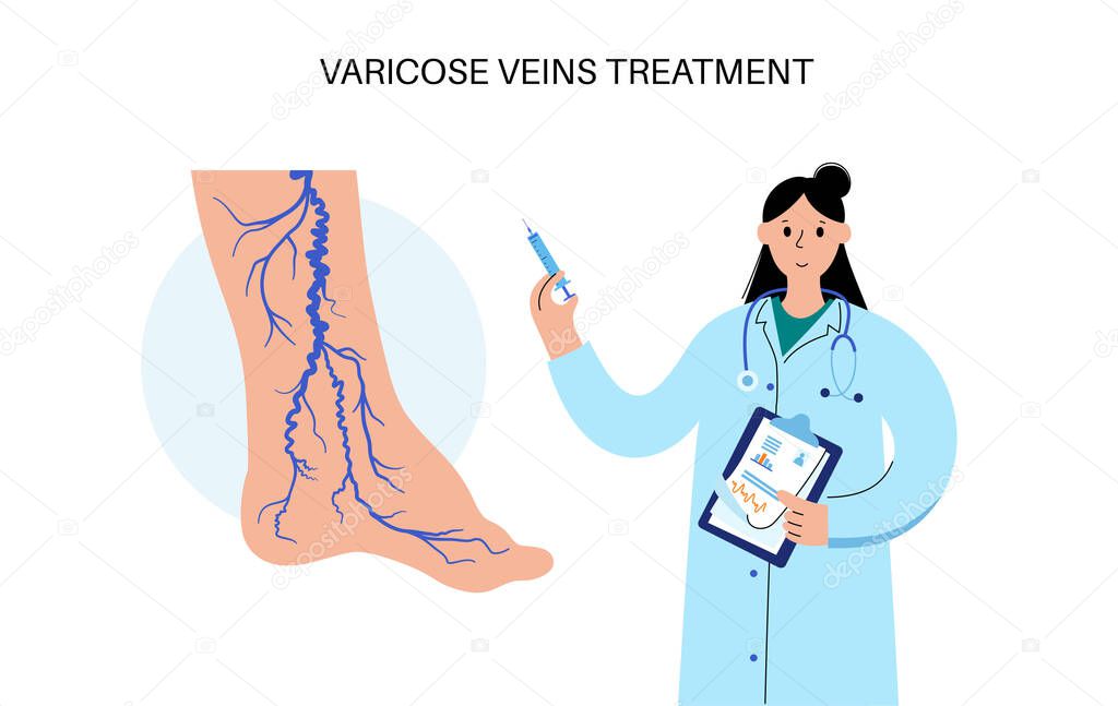 Varicose veins concept. Swelling and pain in human legs. Vascular disease diagnostic and treatment. Abnormal blood pressure, weak vein and valves. Venous insufficiency medical flat vector illustration