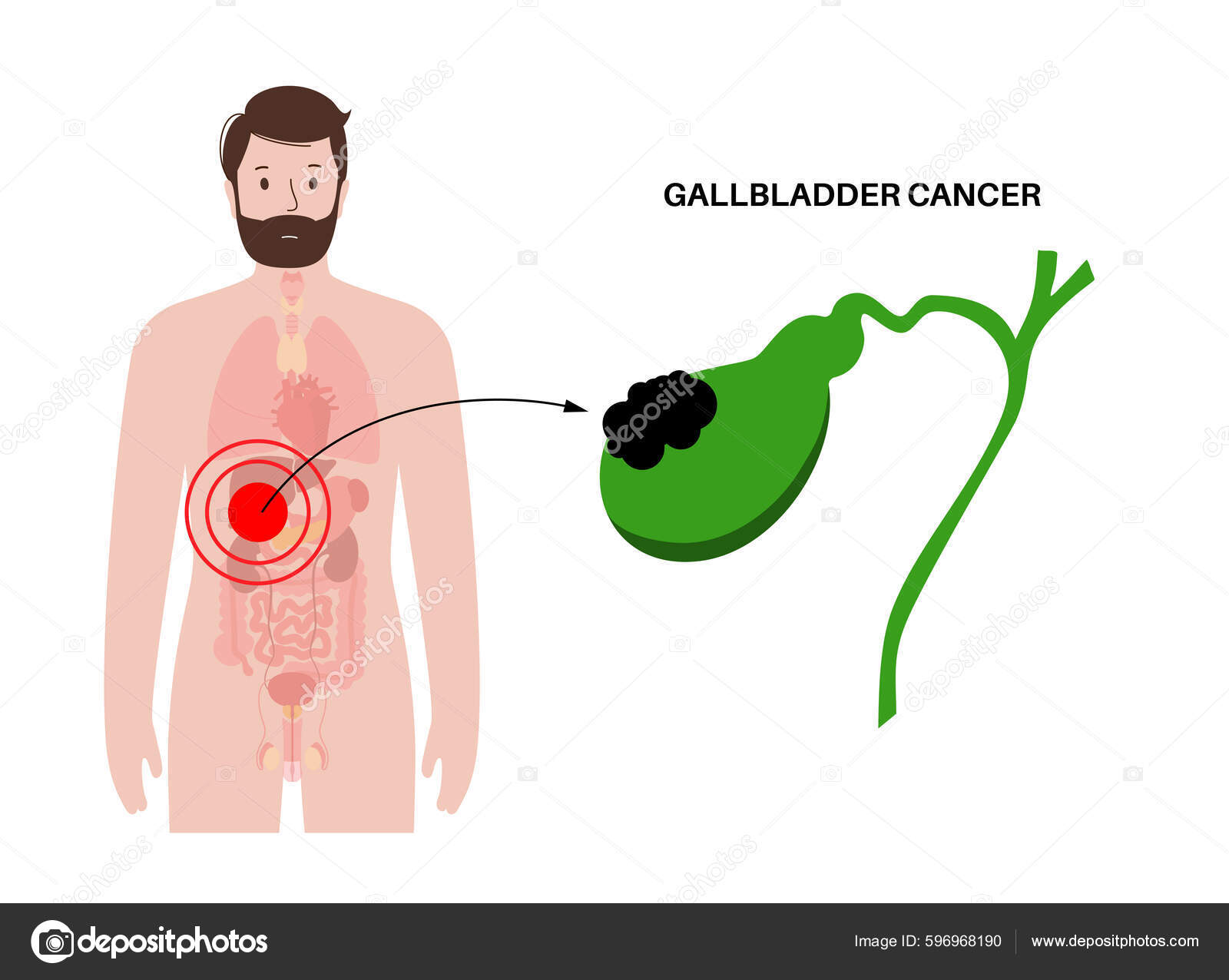 Disección de la #RegiónAbdominal en la que podemos ver ⤵️ 📌#Hígado  📌#Estómago 📌#Bazo 📌#VesículaBiliar 📌#Páncreas 📌#ColonTransverso  📚Gray. Guía de disección del cuerpo humano © 2019, image size:1600x1276