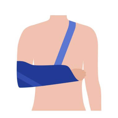 Arm sling fixation. Immobilize wrist in a horizontal position with bandage. Support for hand muscles and bones. Broken or injured joint, fracture, sprained ligaments. First help vector illustration.