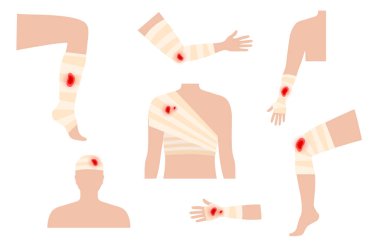 Sore, cut or ulcer on the human body. Pain in leg, arm, shoulder or head. Bandage, medical gauze wrapping. Broken or injured bones, first help. Male silhouette. Limbs trauma vector flat illustration.