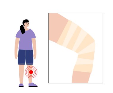 Elastic bandage on human leg. Roll and wrap medical gauze over a knee. Broken or injured joint, sprained ligaments. Healthcare and first help concept. Patient with trauma flat vector illustration