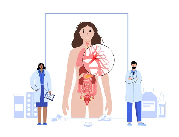 폐활량 색전증 상담하거나 병원에서 의사와 혈전증이요 폐정맥의 혈류를 순환계에 문제가 — 스톡 벡터