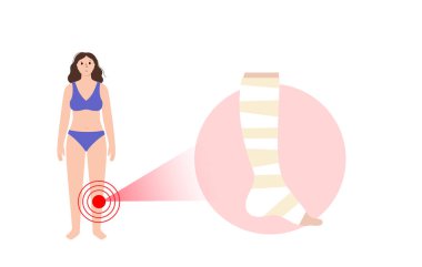 Elastic bandage on human leg. Roll and wrap medical gauze over a foot. Broken or injured ankle. Healthcare concept. First help in a clinic or hospital. Patient with trauma flat vector illustration
