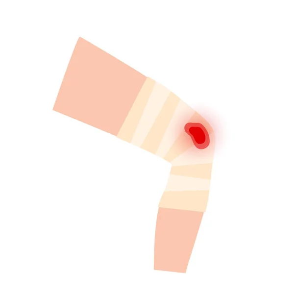 Wunden Schnittwunden Oder Geschwüre Menschlichen Bein Elastischer Verband Medizinische Mullbinde — Stockvektor