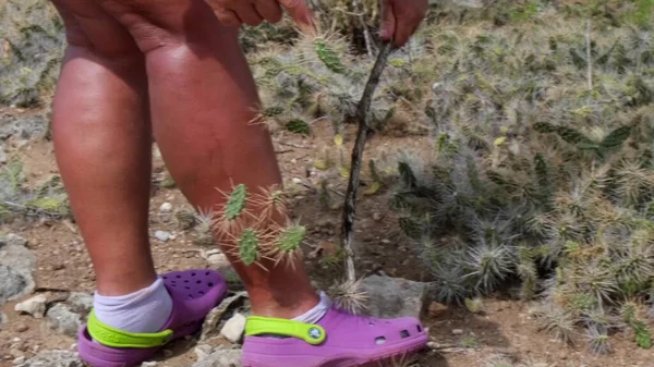 Suceur Sang Cactus Sautant Cactus Enfoncé Dans Jambe Homme — Photo