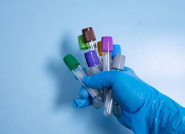 Rurki Próżniowe Pobierania Próbek Krwi Cytrynianem Sodu Niebieskich Rękawiczkach Badań — Zdjęcie stockowe