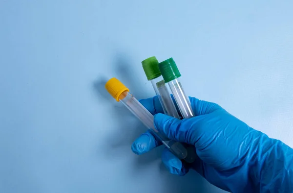 用于采集的真空管和用于实验室的带有柠檬酸钠蓝色手套的血液样本 蓝色背景 — 图库照片
