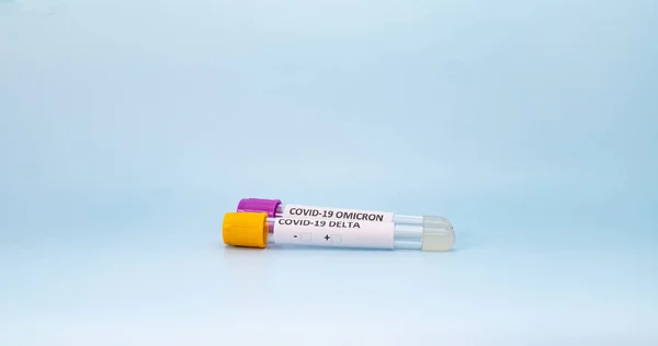 两个真空管用于采集和血液样本与柠檬酸钠实验室 蓝色背景 用于眼镜蛇诊断 — 图库照片
